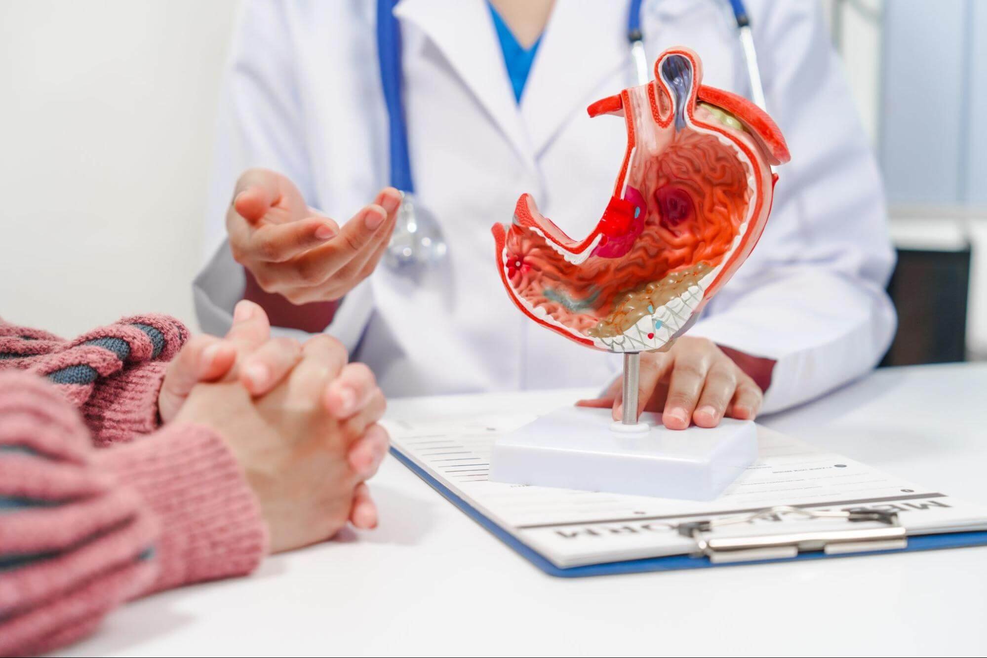 Doctor showing a patient a model of the stomach
