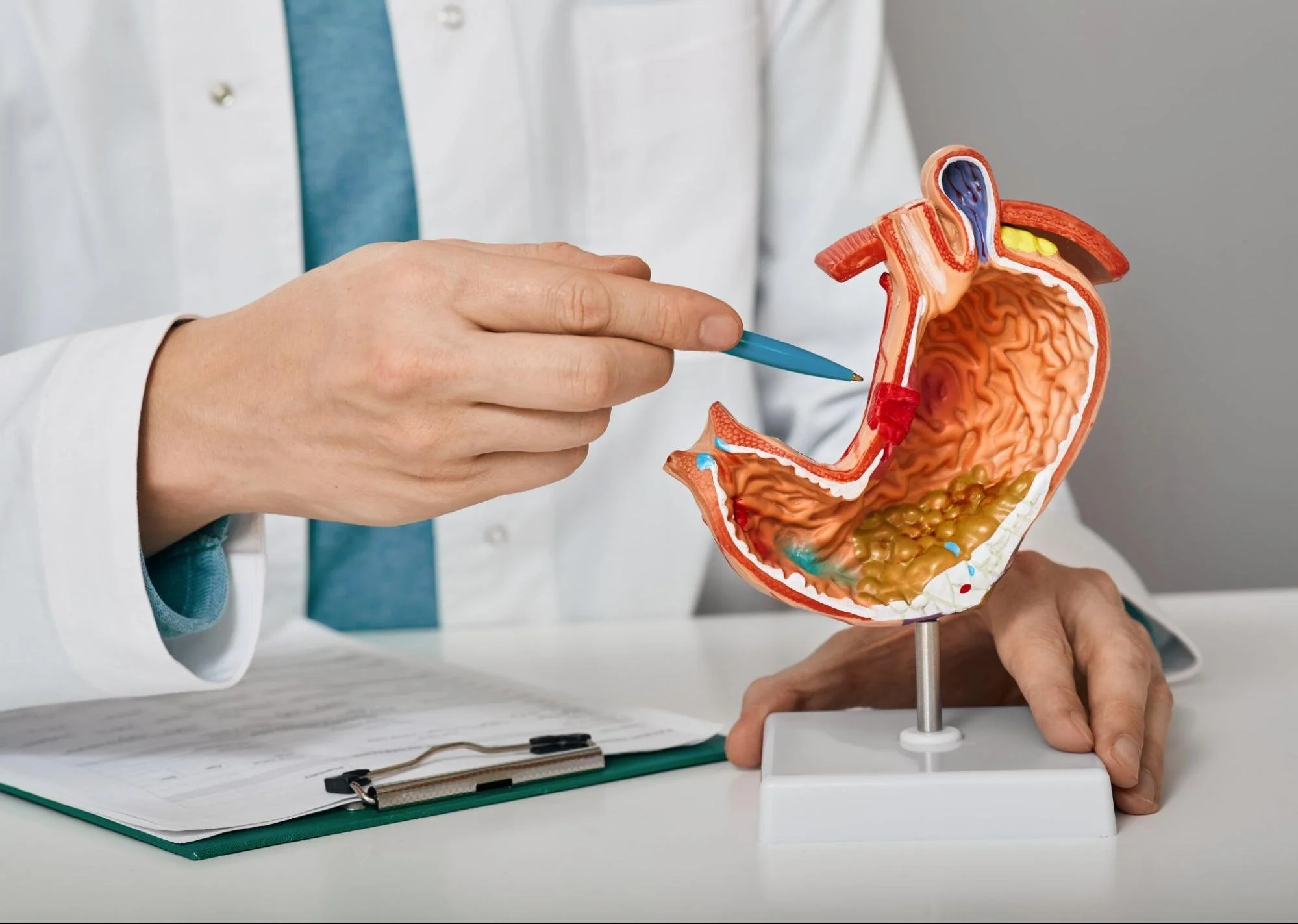 Doctor pointing to a model of the stomach